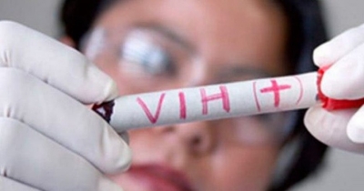 Aumentan los casos de VIH en el estado
