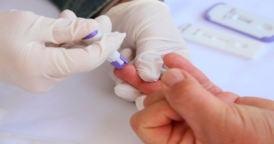 Detectan por año 400 casos de VIH