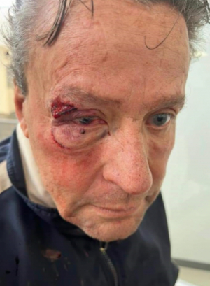 Golpean a Alfredo Adame; hombres declaran que el actor inici&oacute; el pleito