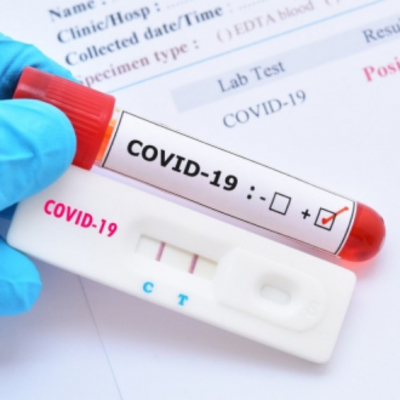 Suben precios de las pruebas COVID