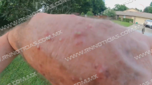 Tamaulipas en alerta por caso de viruela del mono