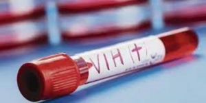 Cient&iacute;ficos logran eliminar el VIH de c&eacute;lulas infectadas