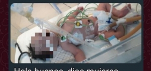 Piden ayuda para beb&eacute; con Hipoxia natal, tiene 6 d&iacute;as de nacido