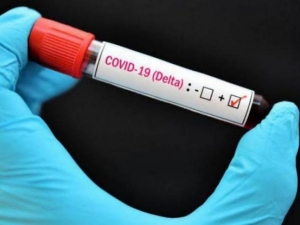 Detectan primer caso de variante Delta de covid en Morelos