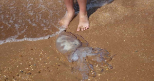 Atiende CR a 8 ba&ntilde;istas por quemaduras de medusas