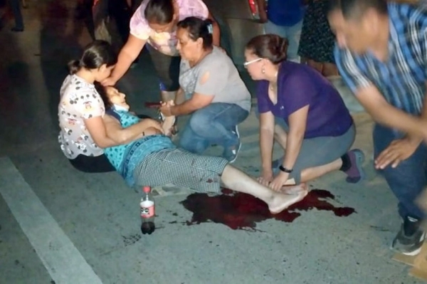 Atropella motociclista a mujer; ambos quedan heridos