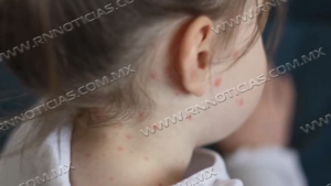 Nuevo Laredo se mantiene sin casos de sarampi&oacute;n y refuerza acciones preventivas con campa&ntilde;a de vacunaci&oacute;n