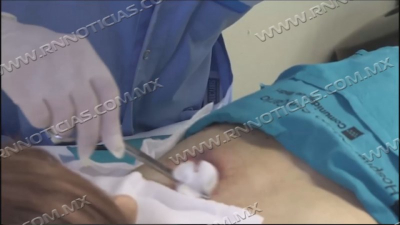 Autoridades de Salud piden a mujeres hacerse revisiones para prevenir c&aacute;ncer de mama