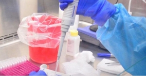 Siguen detectando casos Covid-19, suman 232 m&aacute;s