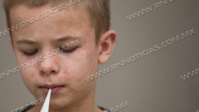 Contin&uacute;a alerta epidemiol&oacute;gica en Nuevo Laredo por casos de Sarampi&oacute;n