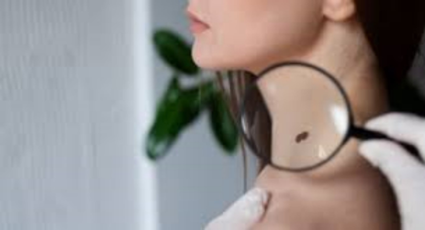 Mujer diagnosticada cáncer terminal se sometió a quimioterapias y descubrió que nunca estuvo enferma