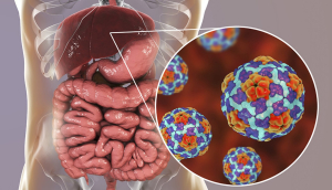 Rastrea Salud origen de brote de hepatitis en el sur