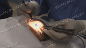 Realiza Sistema DIF campa&ntilde;a de cataratas