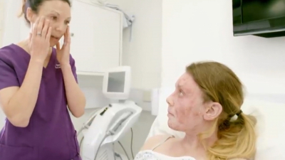 VIDEO Primavera traer&aacute; problem&aacute;ticas de dermatitis y conjuntivitis