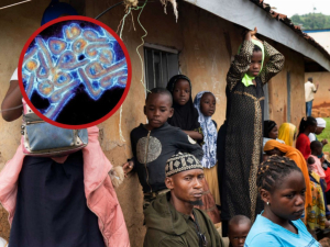 Virus del Marburgo ha dejado al menos 9 muertos en Guinea Ecuatorial; estos son sus síntomas