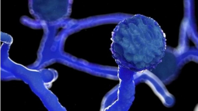 Confirman caso de hongo negro