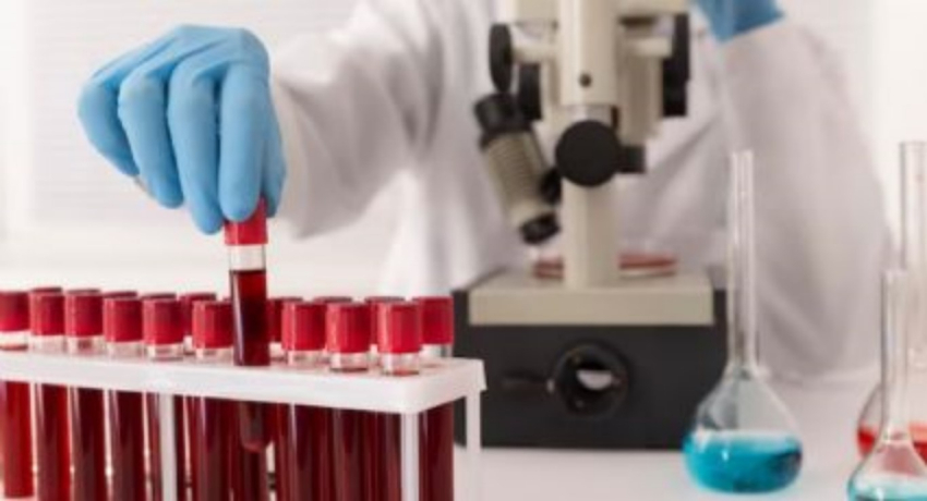 Crean una prueba de sangre capaz de diagnosticar el Trastorno Bipolar