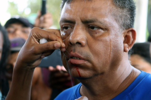 Migrantes se cosen los labios como presi&oacute;n para que les den papeles