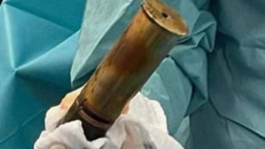 Desalojan hospital por un hombre con una bomba en el recto