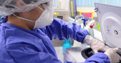 Brotes graves de COVID en Victoria